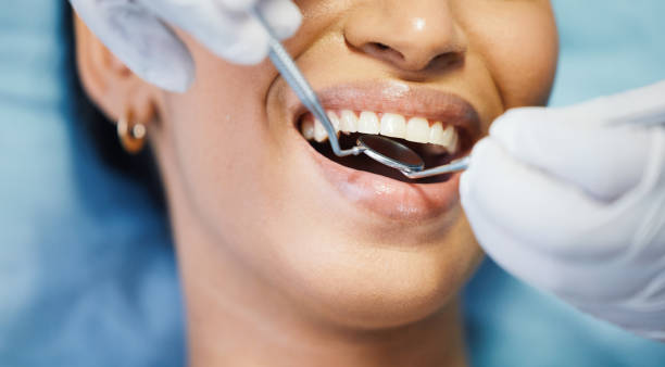 Best Emergency Tooth Extraction in Antelope, CA